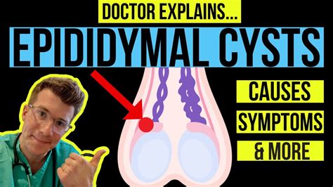 lump on testes hard|epididymis feels hard.